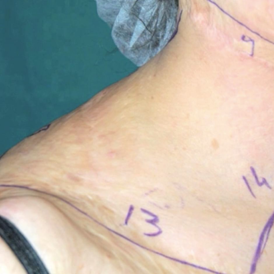 italien schonheitschirurg hilft opfern hauslicher gewalt film in voller lange arte