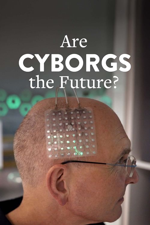 Are Cyborgs the Future?.