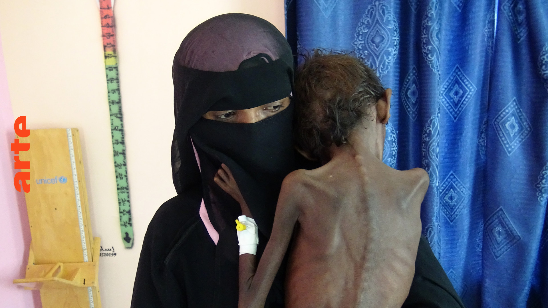 Jemen: Hunger als Kriegswaffe