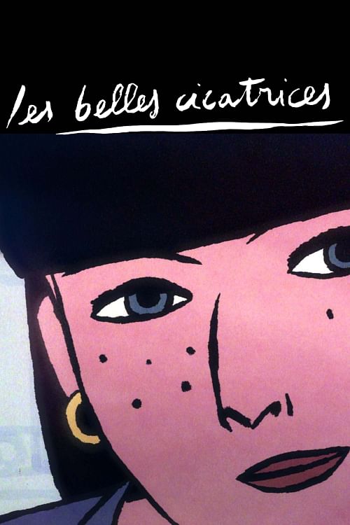 Les belles cicatrices.